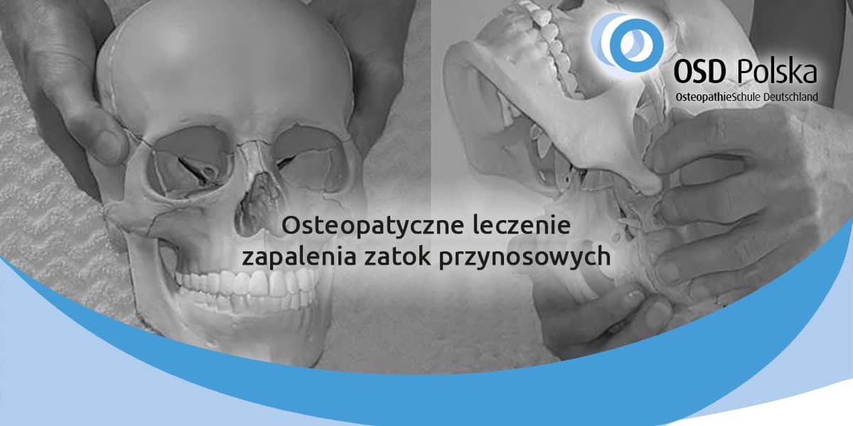 Osteopatyczne leczenie zapalenia zatok przynosowych